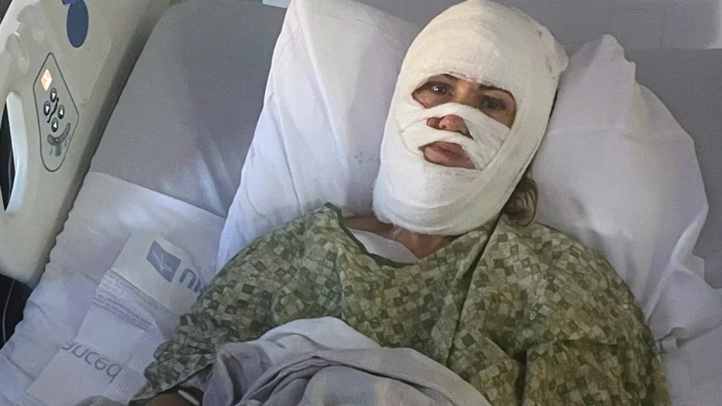 Chemical attack leaves Georgia woman hospitalized with third-degree burns Chemical attack leaves Georgia woman hospitalized with third-degree burns