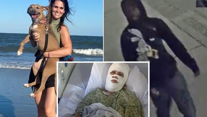 Georgia Woman Attacked With ‘Corrosive’ Chemical After Christmas Event, Suffers Third-Degree Burns Georgia Woman Attacked With 'Corrosive' Chemical After Christmas Event, Suffers Third-Degree Burns