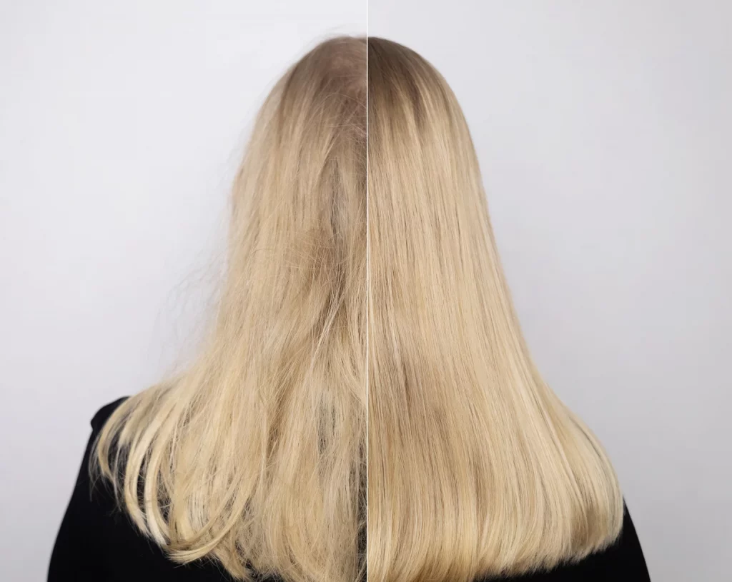 The Bottom Fishing Club - Olaplex: Solid Turnaround Potential In Hair Care (NASDAQ:OLPX)