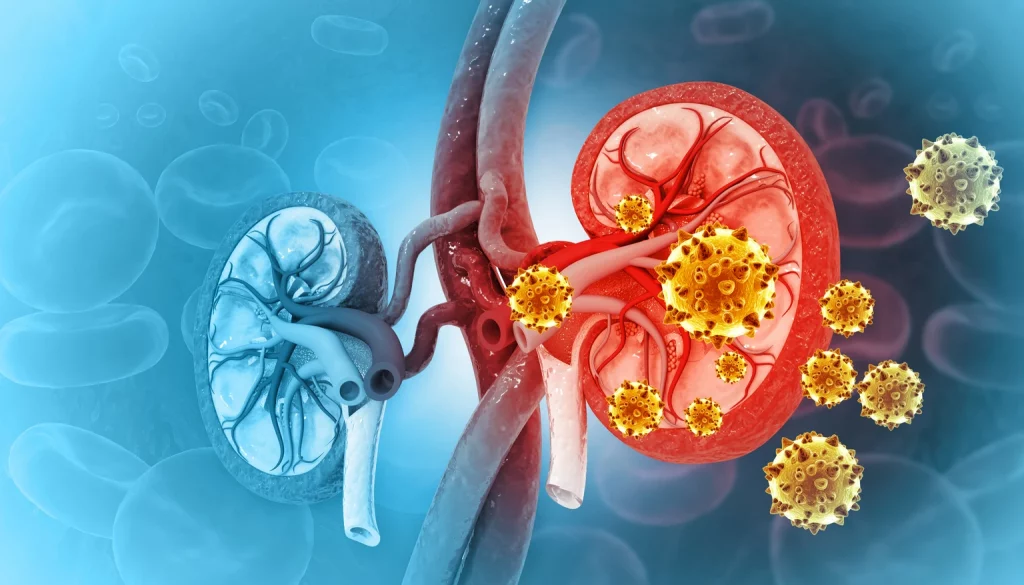 Vera Therapeutics: Stock Rises As IgAN Approval Chances Increase - I'm On Sidelines (VERA)