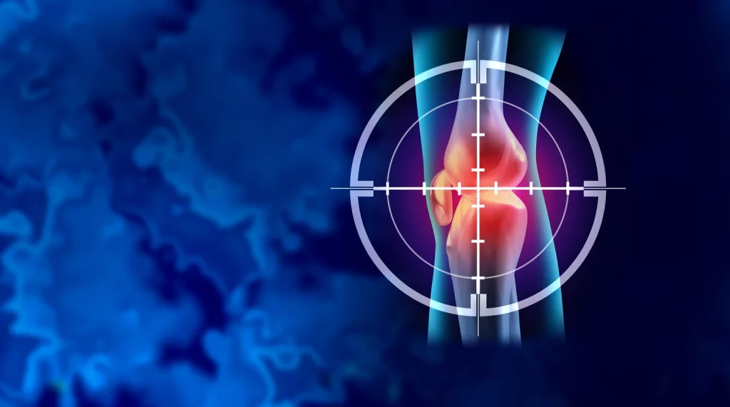 Vericel Stock: Growth Plans May Have Run Out Of Gas (NASDAQ:VCEL) Vericel Stock: Growth Plans May Have Run Out Of Gas (NASDAQ:VCEL)