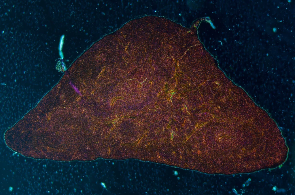 Altimmune Outlook: Where Pemvidutide Phase 3 Is Heading In 2026 (NASDAQ:ALT)